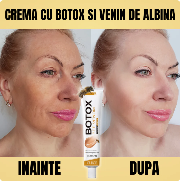 Crema botox cu venin de albine